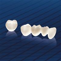 Độ bền của răng sứ Cercon như thế nào ?